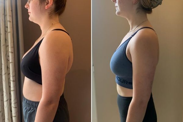 Before & After Fitness Journey